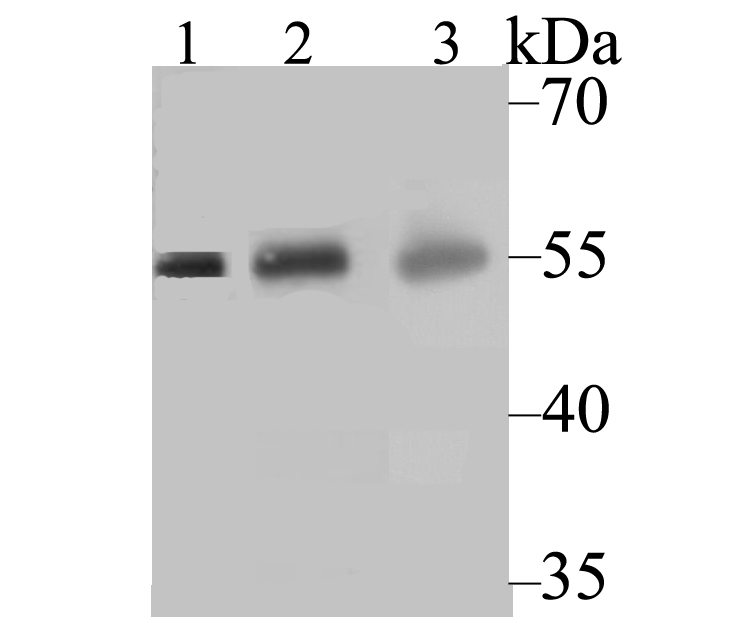 CYP27A1 Antibody