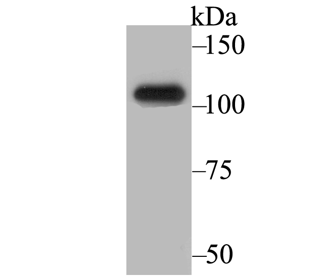 BRD2 Antibody