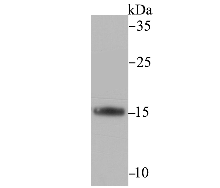 TTC11 Antibody