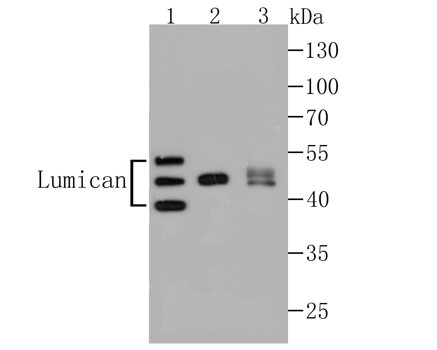 Lumican Antibody