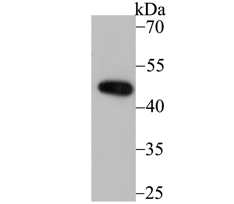 DDB2 Antibody