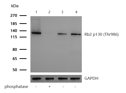 Rb2 p130 (Phospho-Thr986) Rabbit mAb