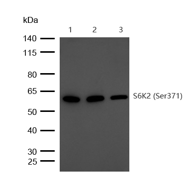 S6K2 (Phospho-Ser371) Rabbit mAb