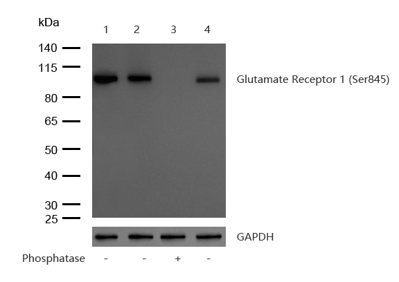 Glutamate Receptor 1 (Phospho-AMPA Subtype) (Phospho-Ser845) Rabbit mAb