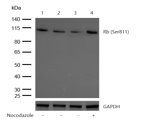 Rb (Phospho-Ser811) Rabbit mAb