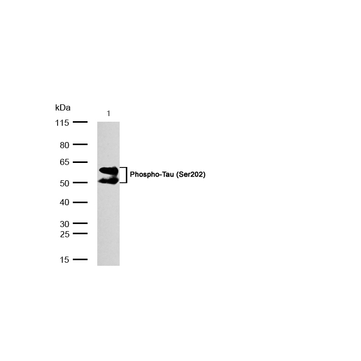Tau (Phospho-Ser202) Rabbit mAb