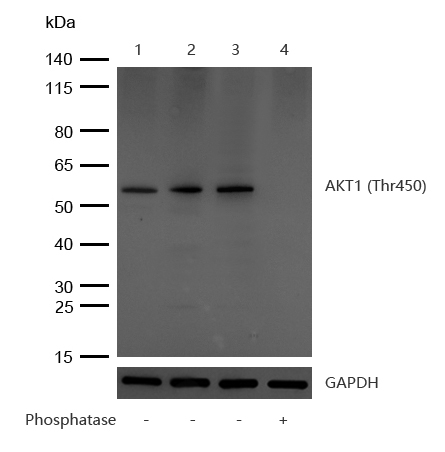 AKT1 (Phospho-Thr450) Rabbit mAb