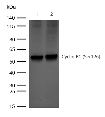 Cyclin B1 (Phospho-Ser126) Rabbit mAb