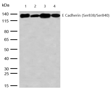 E Cadherin (Phospho-Ser838/Ser840) Rabbit mAb