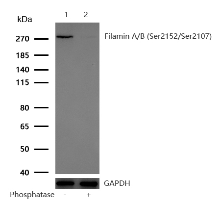 Filamin A/B (Phospho-Ser2152/Ser2107) Rabbit mAb