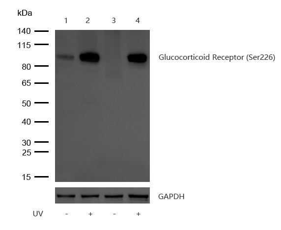 Glucocorticoid Receptor (Phospho-Ser226) Rabbit mAb