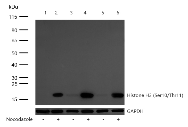 Histone H3 (Phospho-Ser10/Thr11) Rabbit mAb