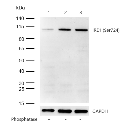 IRE1 (Phospho-Ser724) Rabbit mAb