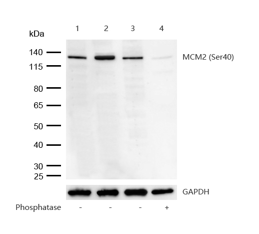 MCM2 (Phospho-Ser40) Rabbit mAb