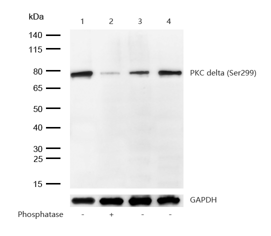 PKC delta (Phospho-Ser299) Rabbit mAb
