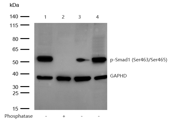 Smad1 (Phospho-Ser463/Ser465) Rabbit mAb