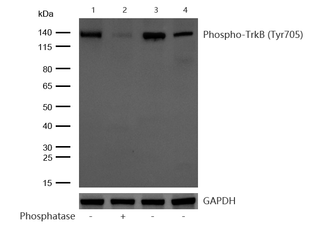 TrkB (Phospho-Tyr705) Rabbit mAb