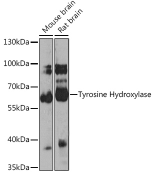 TH Rabbit Polyclonal Antibody