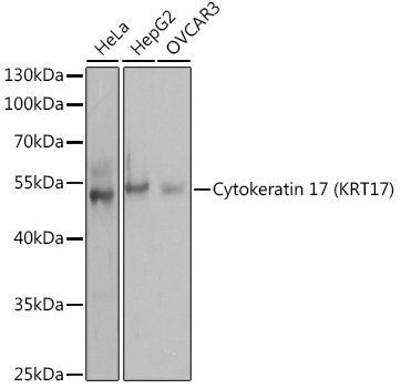 KRT17 Rabbit Polyclonal Antibody
