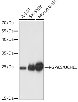 UCHL1 Rabbit Polyclonal Antibody