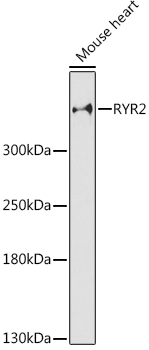 RYR2 Rabbit Polyclonal Antibody