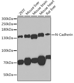 N-Cadherin Rabbit Polyclonal Antibody