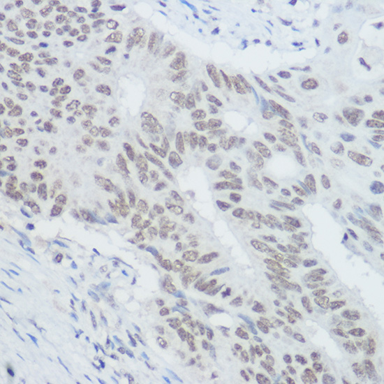 XRCC1 Rabbit Polyclonal Antibody