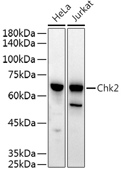 CHEK2 Rabbit Polyclonal Antibody