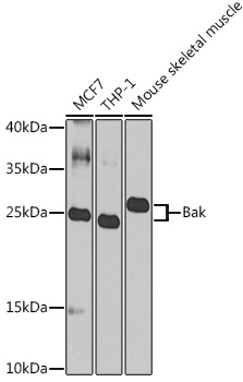 BAK1 Rabbit Polyclonal Antibody