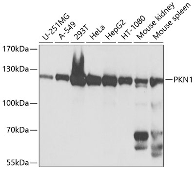 PKN1 Rabbit Polyclonal Antibody