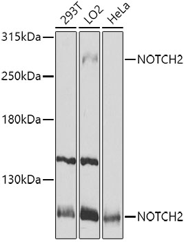 NOTCH2 Rabbit Polyclonal Antibody