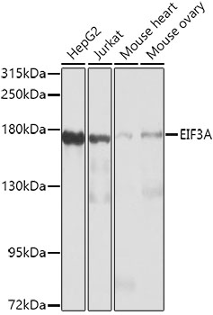 EIF3A Rabbit Polyclonal Antibody