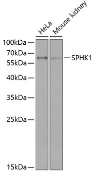 SPHK1 Rabbit Polyclonal Antibody