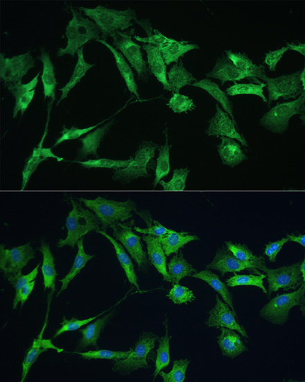 EZR Rabbit Polyclonal Antibody