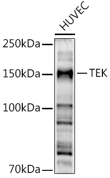 TEK Rabbit Polyclonal Antibody