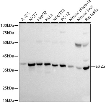 EIF2S1 Rabbit Polyclonal Antibody