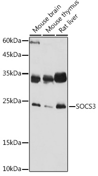 SOCS3 Rabbit Polyclonal Antibody