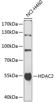 HDAC2 Rabbit Polyclonal Antibody