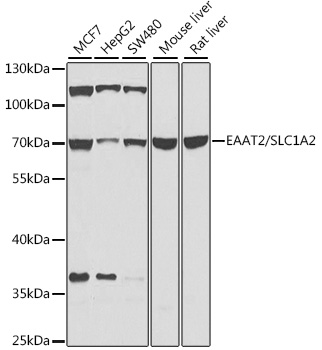 SLC1A2 Rabbit Polyclonal Antibody