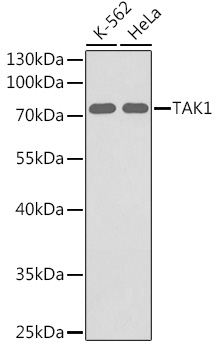MAP3K7 Rabbit Polyclonal Antibody