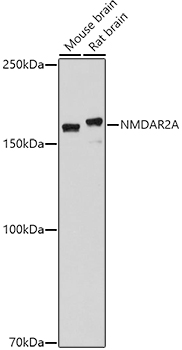 GRIN2A Rabbit Polyclonal Antibody