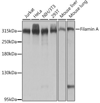 FLNA Rabbit Polyclonal Antibody