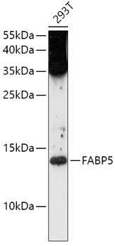 FABP5 Rabbit Polyclonal Antibody