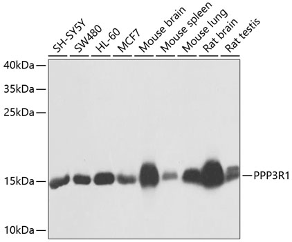PPP3R1 Rabbit Polyclonal Antibody