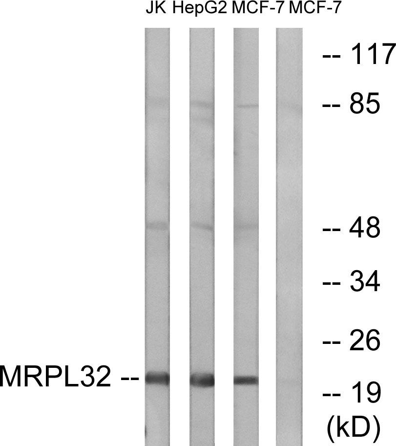 MRPL32 Rabbit Polyclonal Antibody