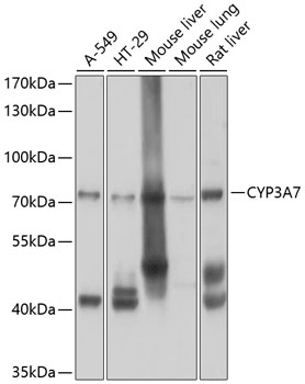 CYP3A7 Rabbit Polyclonal Antibody