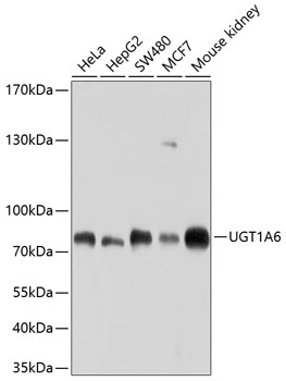 UGT1A6 Rabbit Polyclonal Antibody