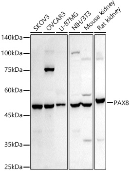 PAX8 Rabbit Polyclonal Antibody