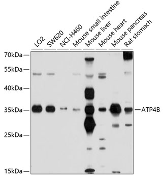ATP4B Rabbit Polyclonal Antibody