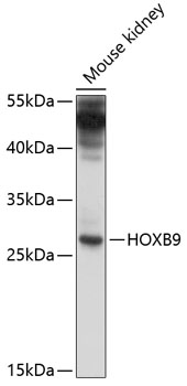 HOXB9 Rabbit Polyclonal Antibody